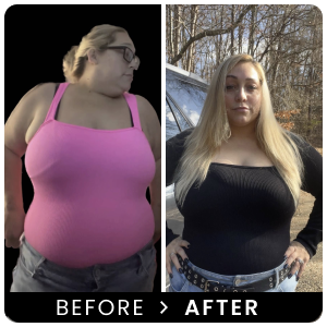 B&A-N2
